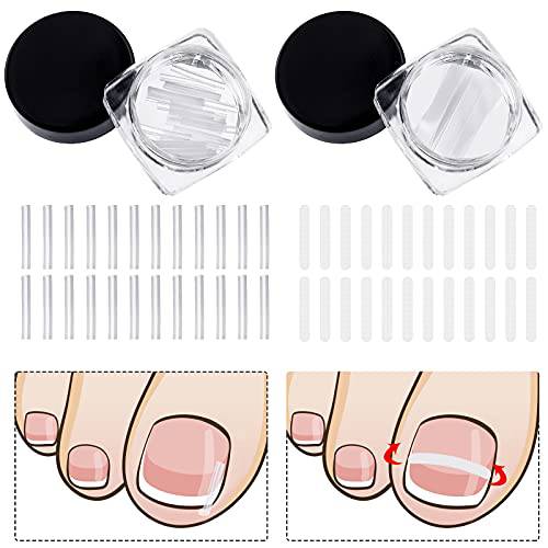 60 Pieces Ingrown Toenail Corrector Strips Ingrown Toenail Correction Brace Toenail Correction Clip Toenail Straightening Recover Patch Curved Toenail Corrector for Women Men Foot Care, 2 Styles